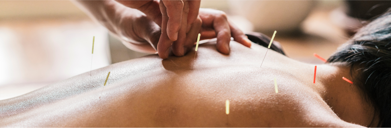 Dr.Yuvaraj Madav's Acupuncture 